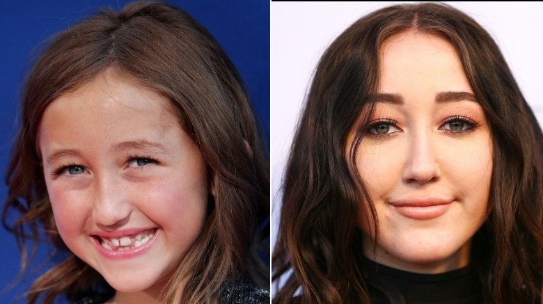 Noah Cyrus avant et après une prétendue chirurgie plastique