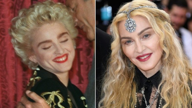 Madonna avant et après la chirurgie plastique