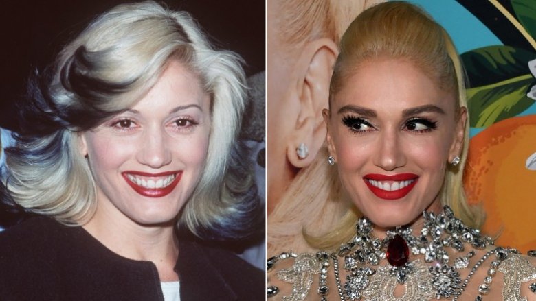 Gwen Stefani avant et après la chirurgie plastique