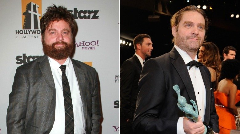 Zach Galifianakis