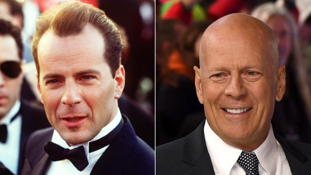 Bruce Willis en smoking à gauche avec des cheveux, chauve à droite