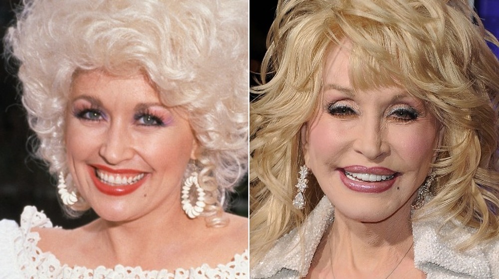 jeune Dolly Parton; aujourd'hui Dolly Parton