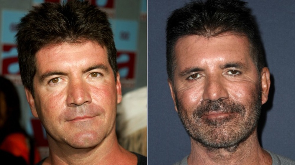 Le jeune Simon Cowell; l'actuel Simon Cowell avec les poils du visage