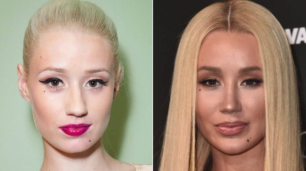 Iggy Azalea avec les cheveux tirés en arrière; Iggy Azalea aux cheveux raides