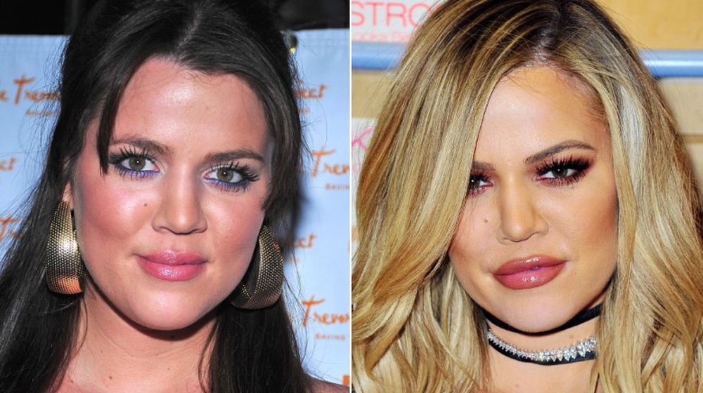 Khloe Kardashian avant la chirurgie; Khloe Kardashian après la chirurgie