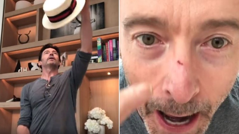 Chapeau de nez Hugh Jackman Instagram 