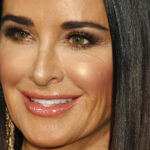 Kyle Richards se demande si elle a déjà fait faire du travail sur son visage