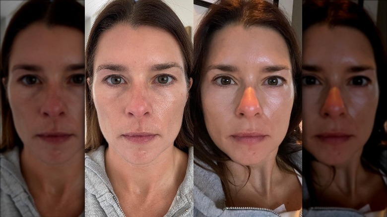 Photos avant-après du visage de Danica Patrick