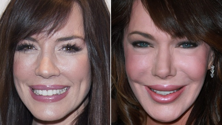 Krista Allen souriant, Hunter Tylo souriant