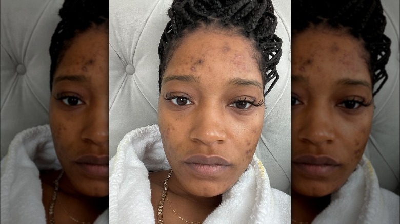 Keke Palmer sans maquillage