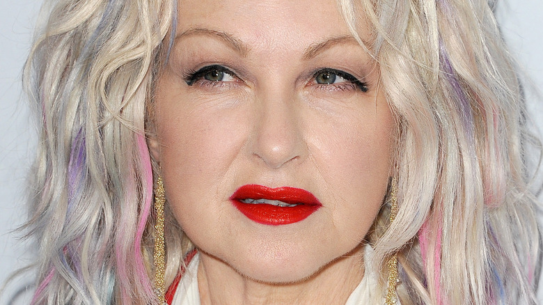 La condition médicale avec laquelle vit Cyndi Lauper