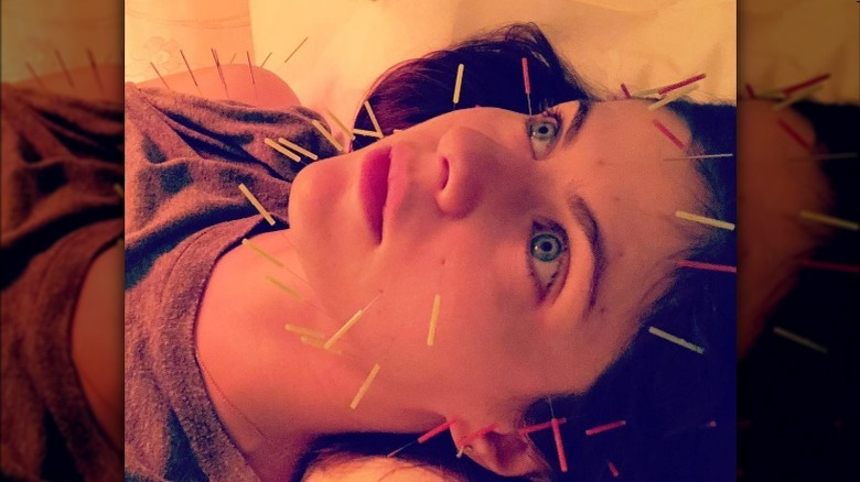 Alexandra Daddario aiguilles d'acupuncture dans le visage