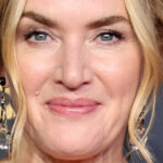 Tout ce que nous savons sur l’hospitalisation de Kate Winslet après un accident sur le plateau