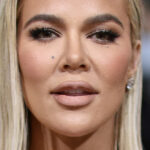 Khloé Kardashian fait le point sur sa santé après une récente alerte au cancer de la peau