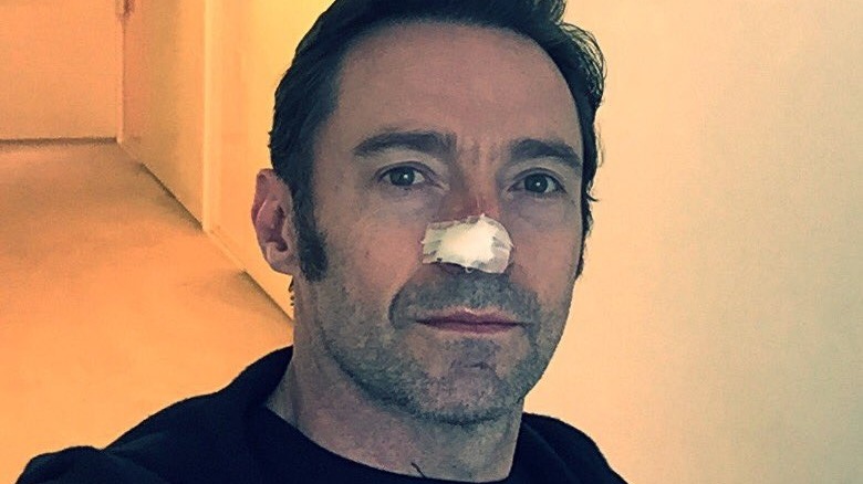 Hugh Jackman dans un selfie avec un bandage nasal 