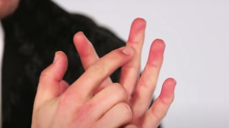 Les mains de Nick Jonas pointant la cicatrice