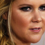 L’effrayant accident de surf qui a laissé Amy Schumer avec 41 points de suture