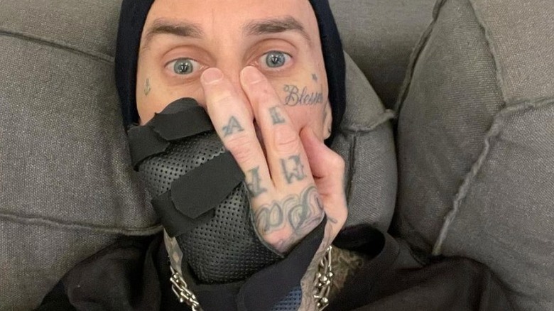 Travis Barker avec les doigts cassés