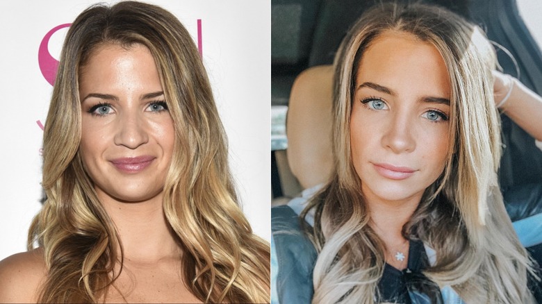 Naomie Olindo rhinoplastie avant et après