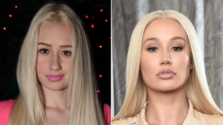 Image divisée d'Iggy Azalea posant pour des photos