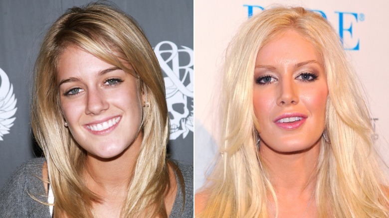 Image fractionnée d'Heidi Montag souriante