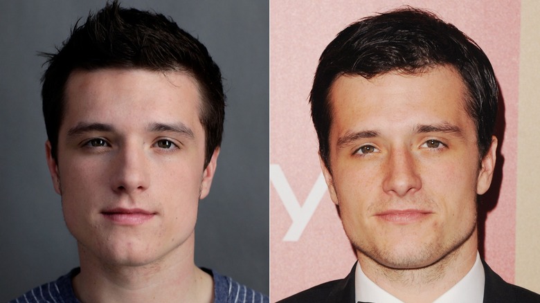 Josh Hutcherson avant et après l'opération