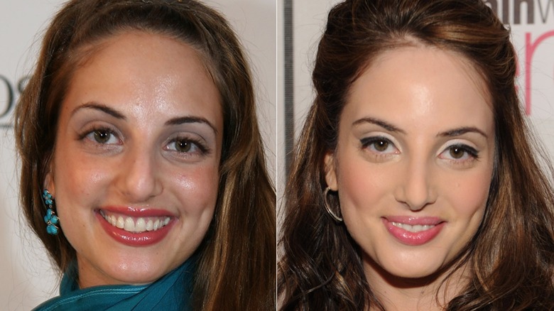 Alexa Ray Joel avant et après la rhinoplastie