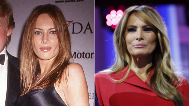 Melania Trump en 1999 et 2024